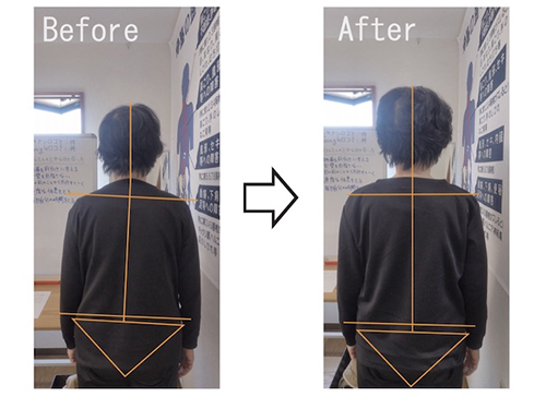 体の状態、施術方針の説明